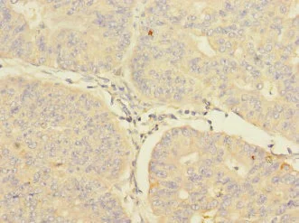 Immunohistochemistry (Formalin/PFA-fixed paraffin-embedded sections) - Anti-CBF1 interacting corepressor/CIR1 antibody - N-terminal (AB229866)