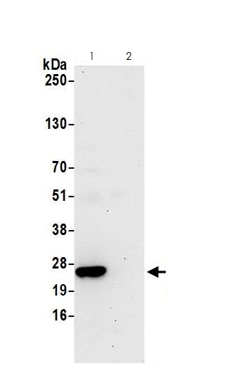 Immunoprecipitation - Anti-CBFb antibody (AB125191), expandable thumbnail