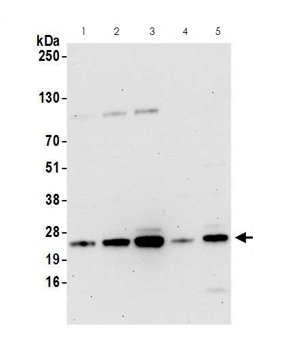 Western blot - Anti-CBFb antibody (AB125191), expandable thumbnail