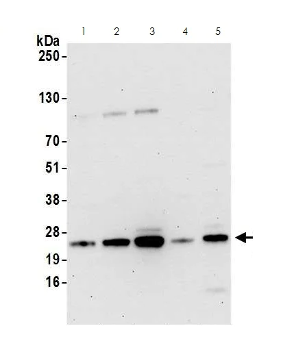 Western blot - Anti-CBFb antibody (AB125191)