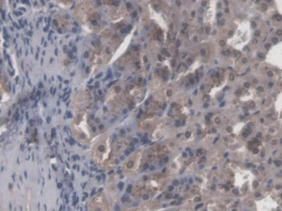 Immunohistochemistry (Formalin/PFA-fixed paraffin-embedded sections) - Anti-CBFb antibody (AB231345)