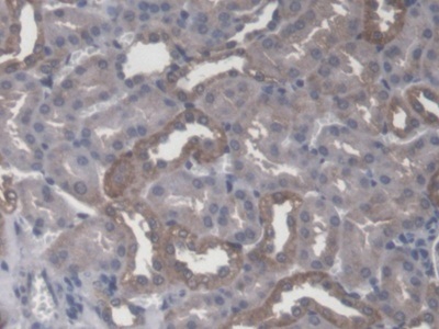 Immunohistochemistry (Formalin/PFA-fixed paraffin-embedded sections) - Anti-CBFb antibody (AB231345)