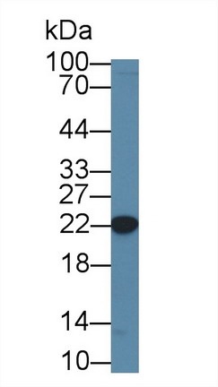 Western blot - Anti-CBFb antibody (AB231345)