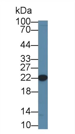 Western blot - Anti-CBFb antibody (AB231345)