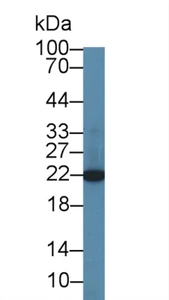 Western blot - Anti-CBFb antibody (AB231345)