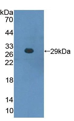 Western blot - Anti-CBFb antibody (AB231345)