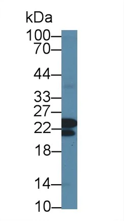 Western blot - Anti-CBFb antibody (AB231345)