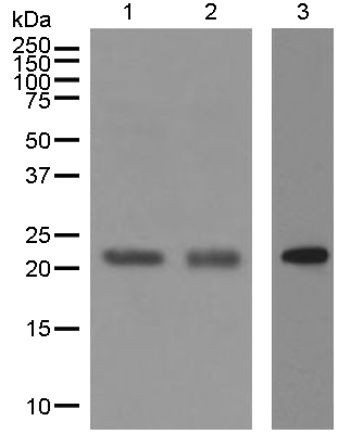 Western blot - Anti-CBFb antibody [EPR6321] (AB124693)