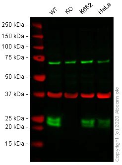 Western blot - Anti-CBFb antibody [EPR6321] - BSA and Azide free (AB247963)