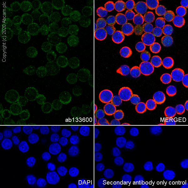 Immunocytochemistry/ Immunofluorescence - Anti-CBFb antibody [EPR6322] (AB133600)