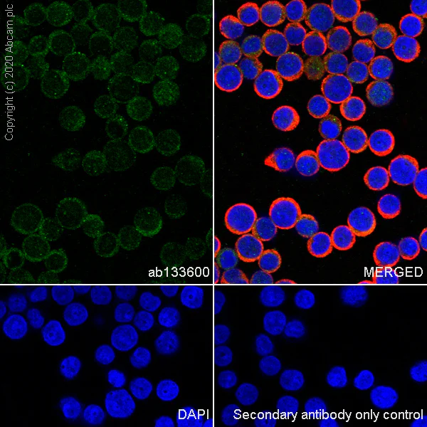 Immunocytochemistry/ Immunofluorescence - Anti-CBFb antibody [EPR6322] (AB133600)