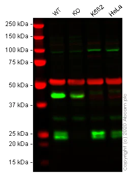 Western blot - Anti-CBFb antibody [EPR6322] (AB133600)