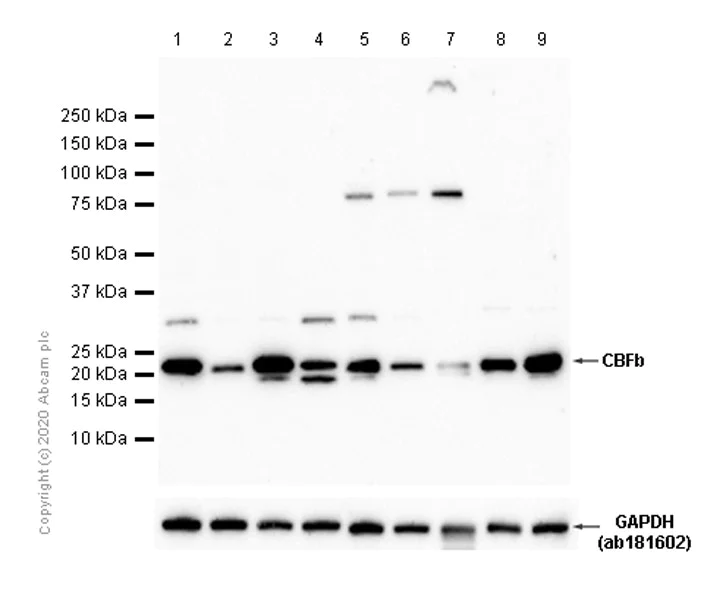 Western blot - Anti-CBFb antibody [EPR6322] (AB133600)