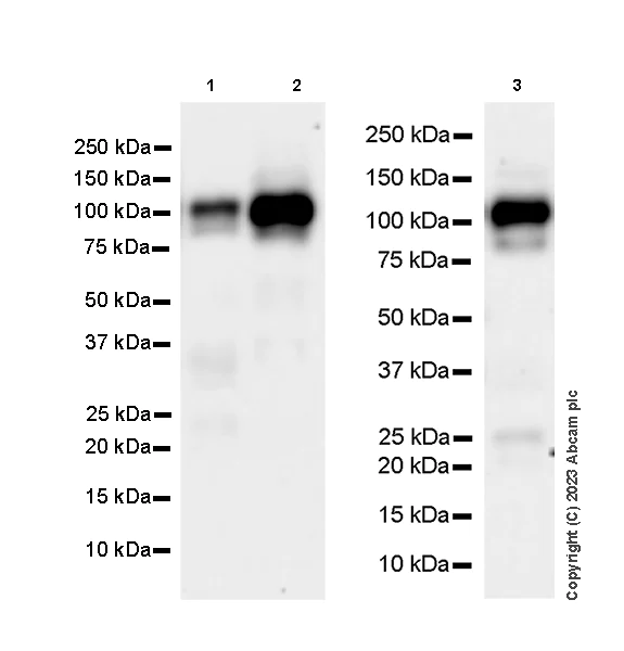 Western blot - Anti-CBL antibody [17/c-Cbl] (AB309549)