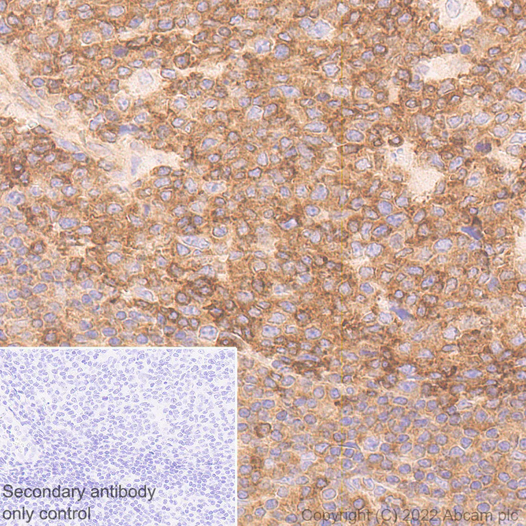 Immunohistochemistry (Formalin/PFA-fixed paraffin-embedded sections) - Anti-CBL antibody [17/c-Cbl] - BSA and Azide free (AB309550)