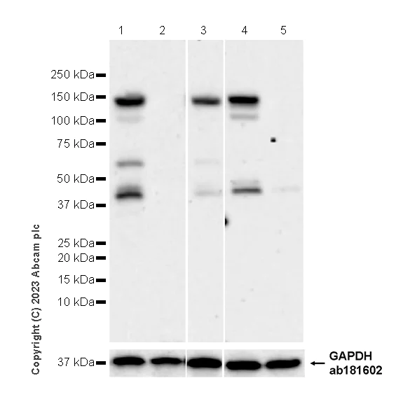 Western blot - Anti-CBL antibody [17/c-Cbl] - BSA and Azide free (AB309550)