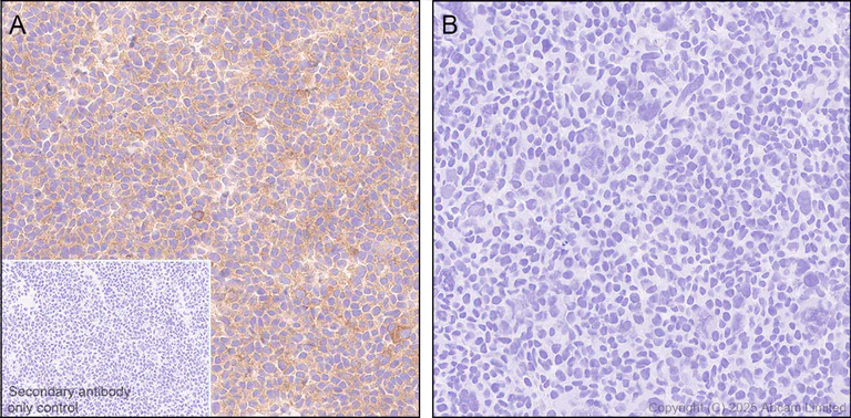 Immunohistochemistry (Formalin/PFA-fixed paraffin-embedded sections) - Anti-CBL antibody [EPR25388-126] (AB324458)