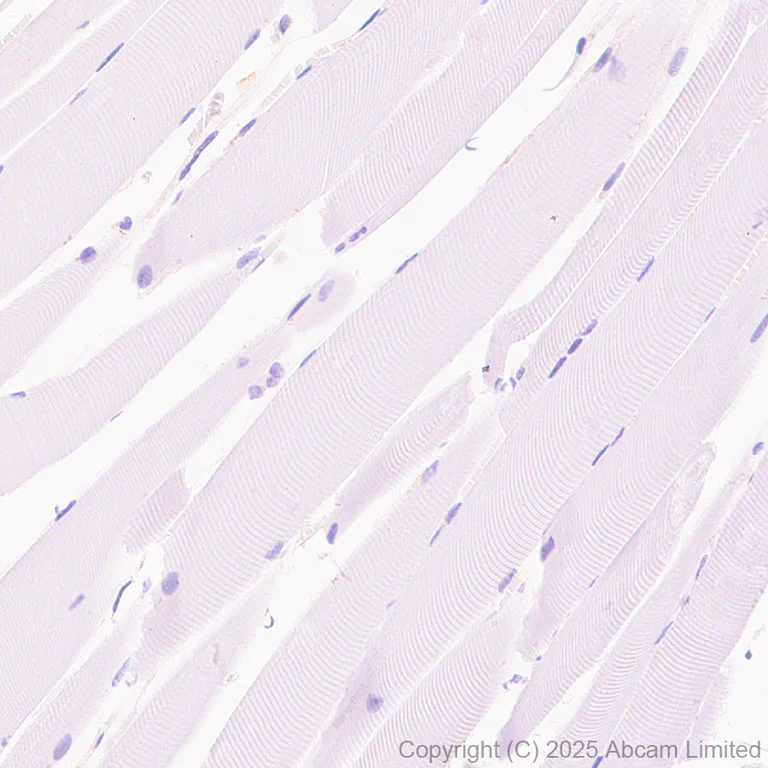 Immunohistochemistry (Formalin/PFA-fixed paraffin-embedded sections) - Anti-CBL antibody [EPR25388-126] (AB324458)