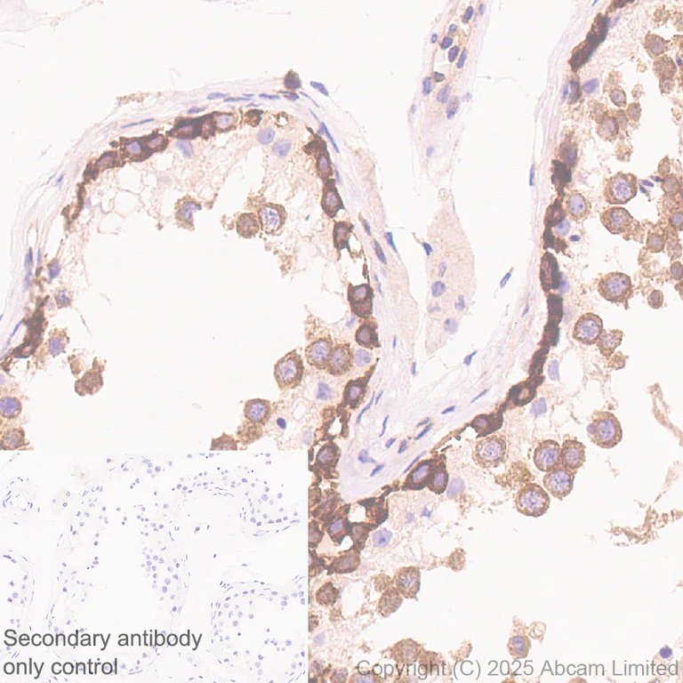 Immunohistochemistry (Formalin/PFA-fixed paraffin-embedded sections) - Anti-CBL antibody [EPR25388-126] (AB324458)
