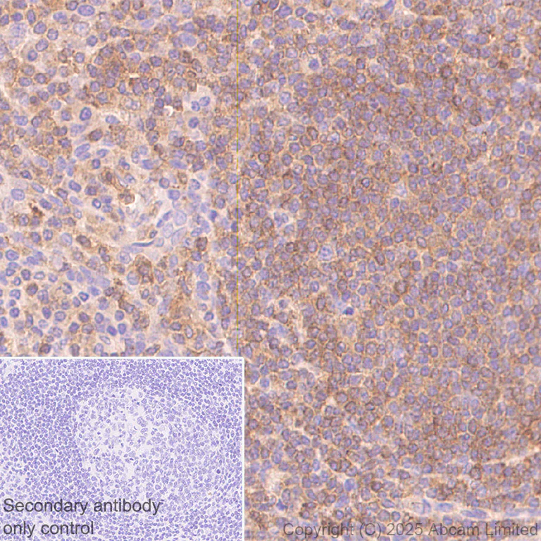 Immunohistochemistry (Formalin/PFA-fixed paraffin-embedded sections) - Anti-CBL antibody [EPR25388-126] (AB324458)
