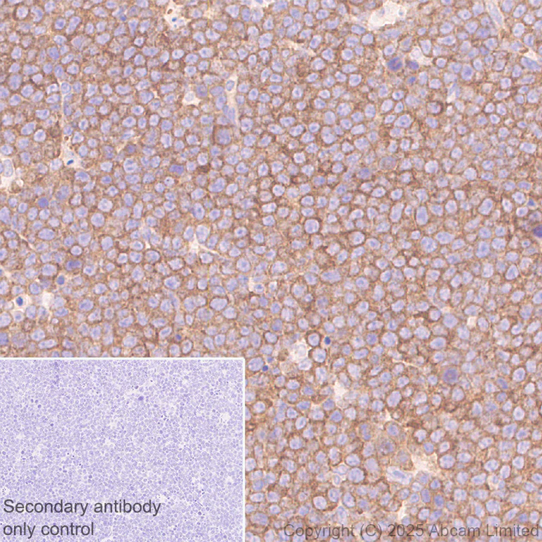 Immunohistochemistry (Formalin/PFA-fixed paraffin-embedded sections) - Anti-CBL antibody [EPR25388-126] (AB324458)