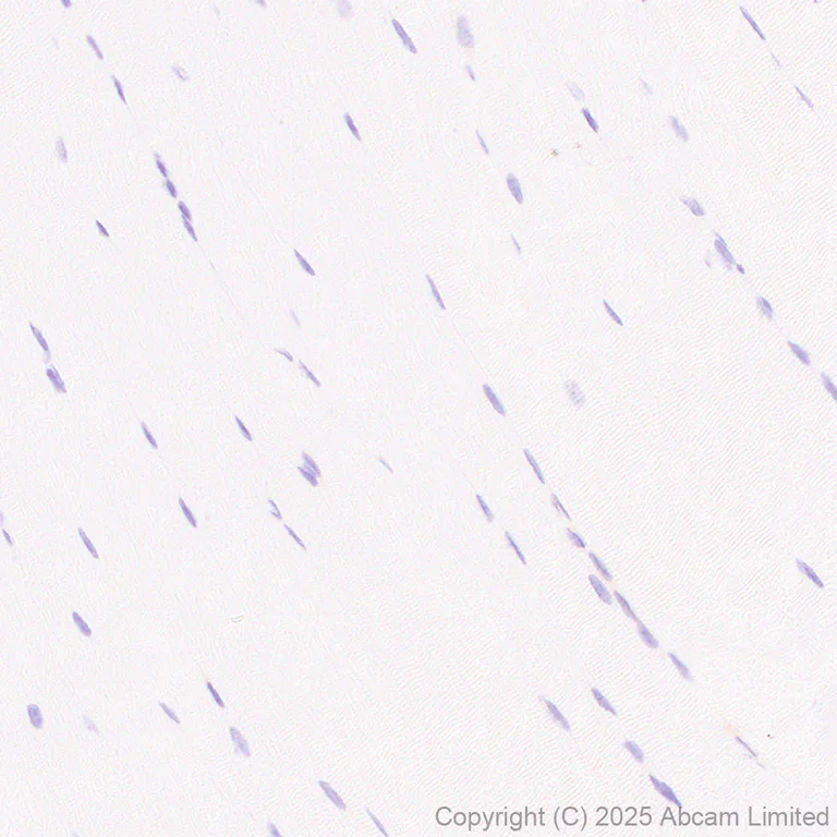 Immunohistochemistry (Formalin/PFA-fixed paraffin-embedded sections) - Anti-CBL antibody [EPR25388-126] (AB324458)