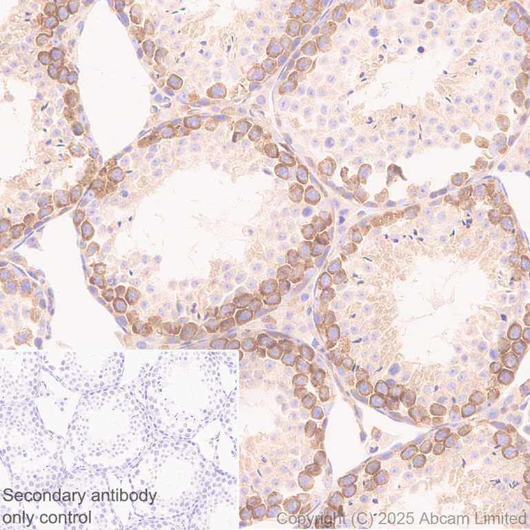 Immunohistochemistry (Formalin/PFA-fixed paraffin-embedded sections) - Anti-CBL antibody [EPR25388-126] (AB324458)