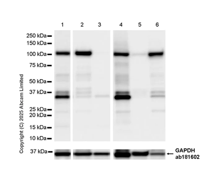 Western blot - Anti-CBL antibody [EPR25388-126] (AB324458)