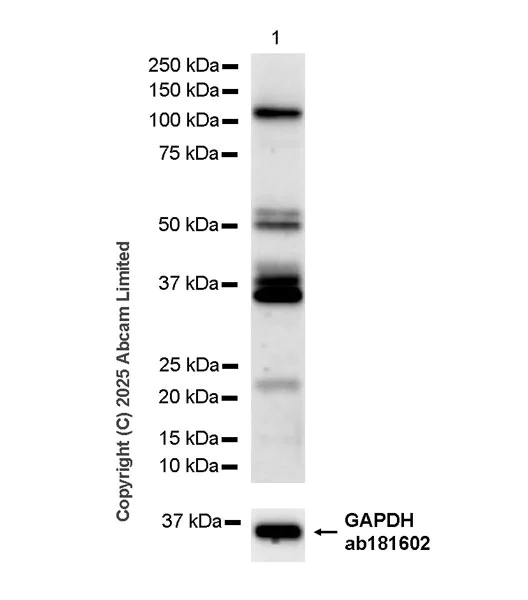 Western blot - Anti-CBL antibody [EPR25388-126] (AB324458)