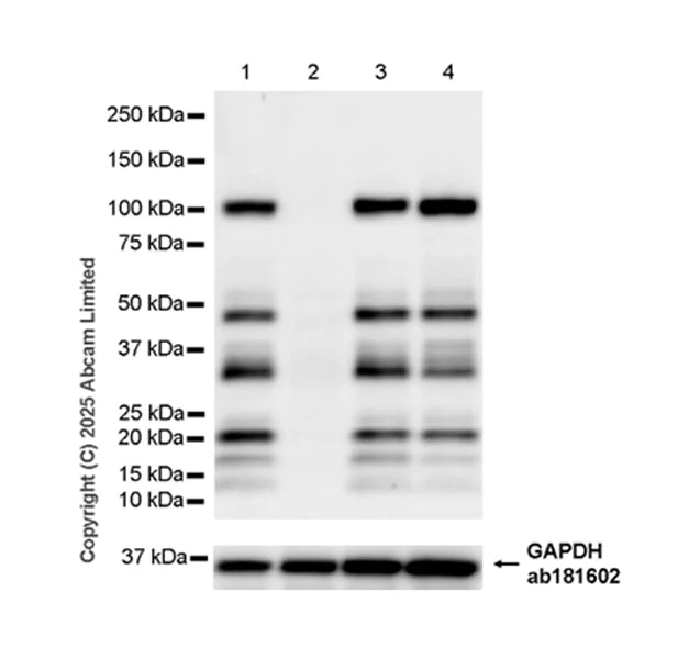 Western blot - Anti-CBL antibody [EPR25388-126] (AB324458)