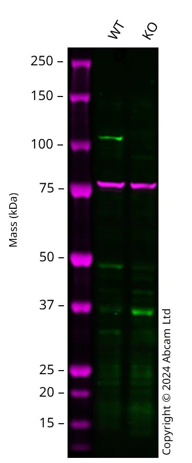 Western blot - Anti-CBL antibody [YE323] - BSA and Azide free (AB236075)