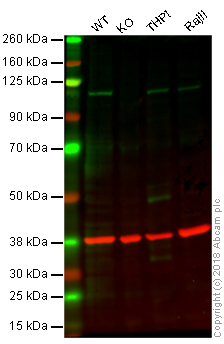 Western blot - Anti-CBL antibody [YE323] - C-terminal (AB32027), expandable thumbnail
