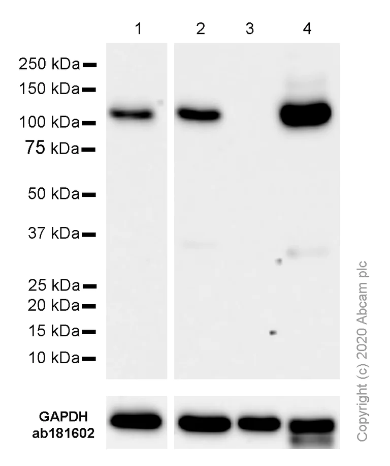 Western blot - Anti-CBL antibody [YE323] - C-terminal (AB32027)
