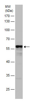 Western blot - Anti-Cbl-c antibody (AB228785)