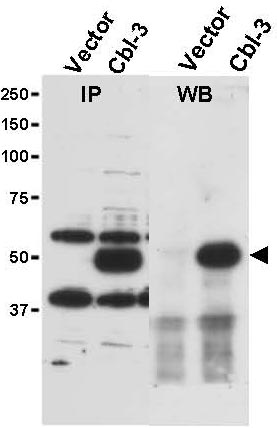 Western blot - Anti-Cbl-c antibody (AB34750)