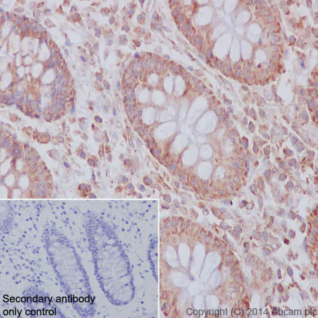 Immunohistochemistry (Formalin/PFA-fixed paraffin-embedded sections) - Anti-CBL + CBLB antibody [YE315] (AB32425)