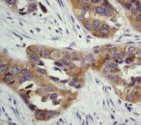 Immunohistochemistry (Formalin/PFA-fixed paraffin-embedded sections) - Anti-CBL + CBLB antibody [YE315] (AB32425)