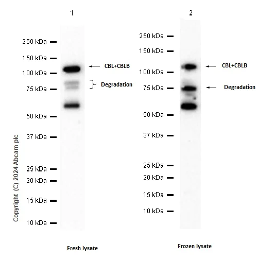 Western blot - Anti-CBL + CBLB antibody [YE315] (AB32425)