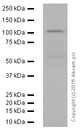 Western blot - Anti-CBL + CBLB antibody [YE315] (AB32425)