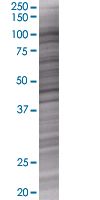 CBL overexpression 293T lysate (whole cell)