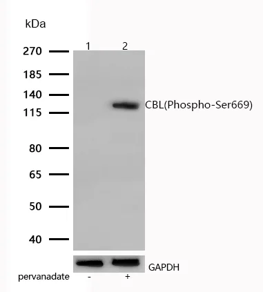 Western blot - Anti-CBL (phospho S669) antibody [SR1097] (AB326665)