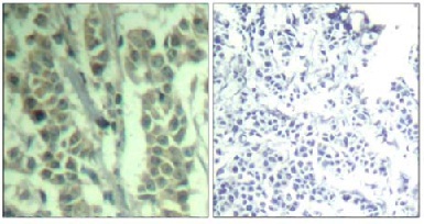 Immunohistochemistry (Formalin/PFA-fixed paraffin-embedded sections) - Anti-CBL (phospho Y700) antibody (AB131345)