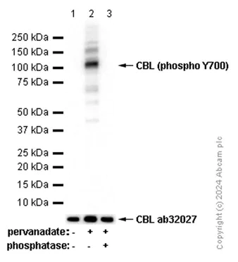 Western blot - Anti-CBL (phospho Y700) antibody [EP2225Y] - BSA and Azide free (AB284732)