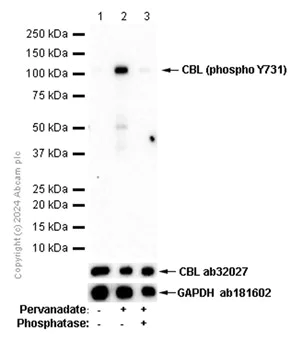 Western blot - Anti-CBL (phospho Y731) antibody [EP973Y] - BSA and Azide free (AB284695)