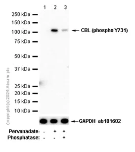 Western blot - Anti-CBL (phospho Y731) antibody [EP973Y] - BSA and Azide free (AB284695)