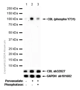 Western blot - Anti-CBL (phospho Y731) antibody [EP973Y] - BSA and Azide free (AB284695)