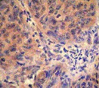 Immunohistochemistry (Formalin/PFA-fixed paraffin-embedded sections) - Anti-CBL (phospho Y774) antibody [E160] (AB32446), expandable thumbnail