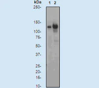 Western blot - Anti-CBL (phospho Y774) antibody [E160] (AB32446)