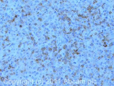 Immunohistochemistry (Formalin/PFA-fixed paraffin-embedded sections) - Anti-CBLB antibody [246C5a] (AB54362)