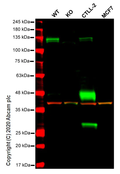 Western blot - Anti-CBLB antibody [246C5a] (AB54362)